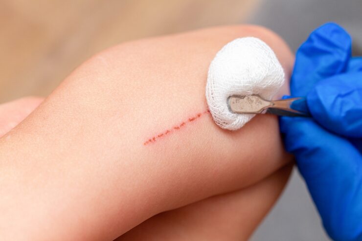 treating scratches child s hand close up 157402 1835